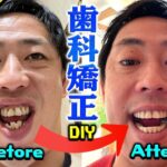 【画像】さらば森田の歯、一年の歯科矯正でめちゃくちゃ綺麗になるｗｗｗｗｗｗ