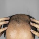 エナジードリンク、男性の抜け毛が増えることが判明